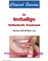 Clinical Success in Invisalign Orthodontic Treatment (pdf)